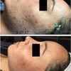 Diverse Skin Solutions & Acne Care