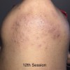 Laser Remedy MedSpa