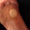 Sudbury Podiatry