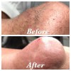 Smooth Image Electrolysis