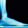 Bluegrass Regional Foot