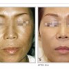Niyan Medspa: Kajal Roy, MD