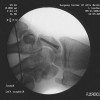 Lamont J Cardon MD