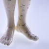 5 Point Acupuncture