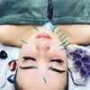 Acupuncture Health & Wellness