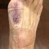 Michael W Nagy, MD FACS