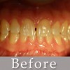 Crescent Dental Associates
