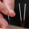 Lok Acupuncture Clinic