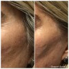 Premier Med Spa & Weight Loss