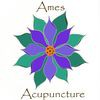 Ames Acupuncture