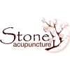 Stone Acupuncture