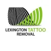 Lexington Tattoo Removal