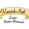 Vanish-Ink Laser Tattoo Removal