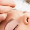 South Hill Acupuncture Clinic