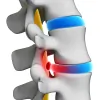 Epic Pain Management
