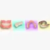 Iverson Dental Labs
