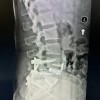 Central Texas Spine Institute