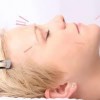 Kane Acupuncture