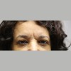 Eye Plastic Associates