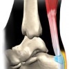 Summit Physical Therapy