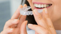Invisalign