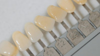 Dental Crowns