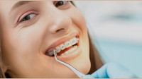 Teen Braces