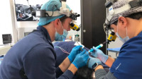FUE Hair Transplant