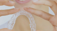 Clear Aligners - Invisalign