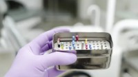 Root Canal Treatment