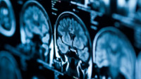 Brain Injury Law