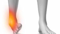 Ankle Sprains